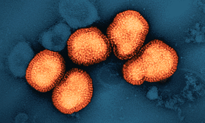 magnified flu cells